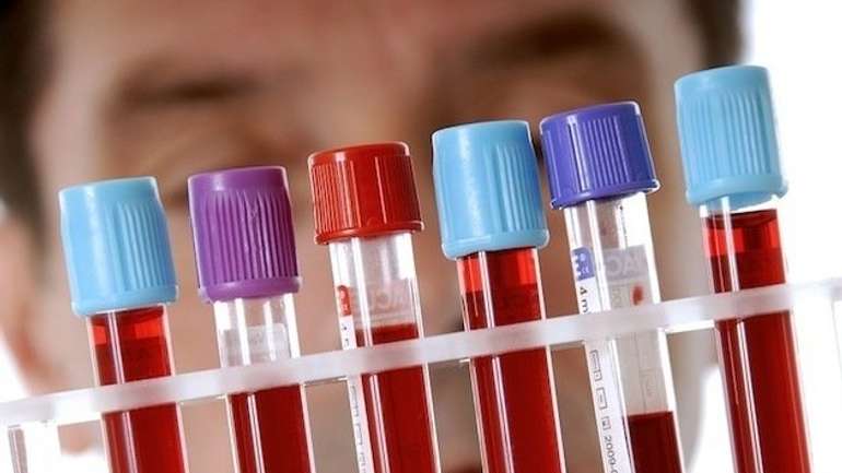 Маленькому полтавцеві терміново треба IV(+) група крові 