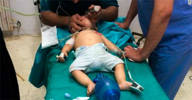 Чуркін заявив в ООН, що сирійських дітей присипають пилом, щоб видати їх за жертв бомбардування_6