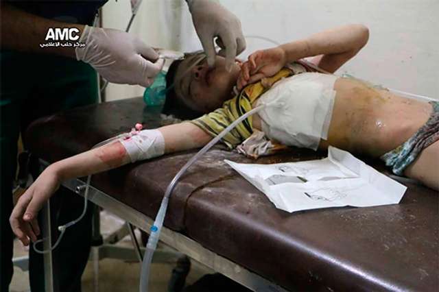 Чуркін заявив в ООН, що сирійських дітей присипають пилом, щоб видати їх за жертв бомбардування_10