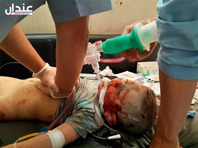 Чуркін заявив в ООН, що сирійських дітей присипають пилом, щоб видати їх за жертв бомбардування_12