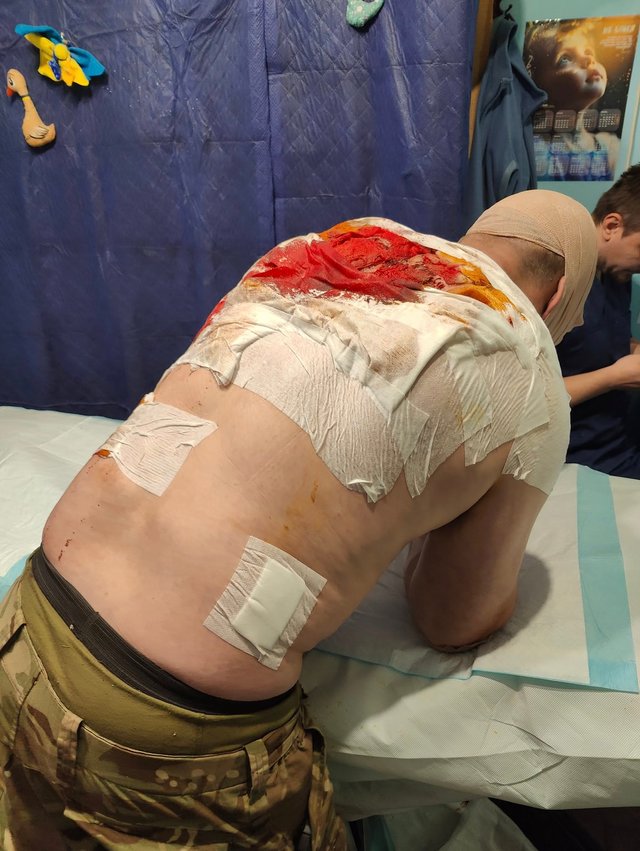 Ціна служби: бойовий медик між фронтом і байдужістю_4