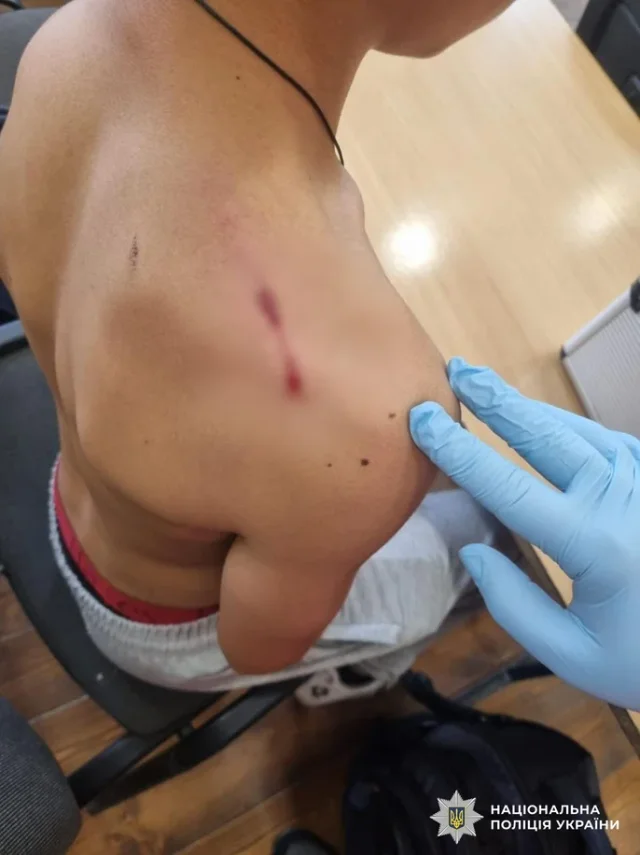 На Закарпатті 9-класник приніс у школу пістолет і вистрілив у свого однокласника_3