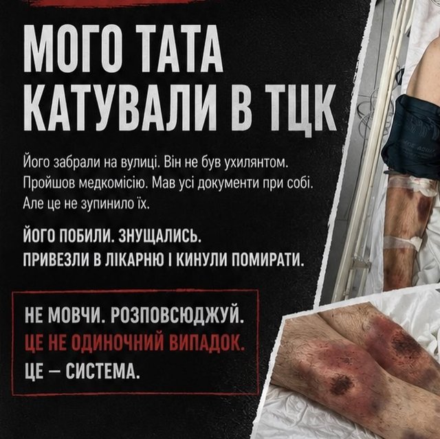 Батько в реанімації: киянка заявила про побиття родича в ТЦК_1