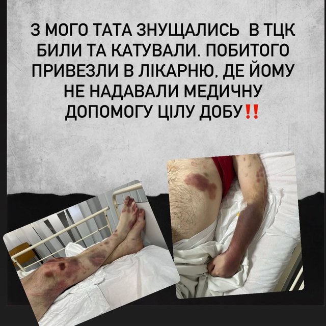 Батько в реанімації: киянка заявила про побиття родича в ТЦК_5