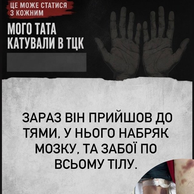 Батько в реанімації: киянка заявила про побиття родича в ТЦК_8