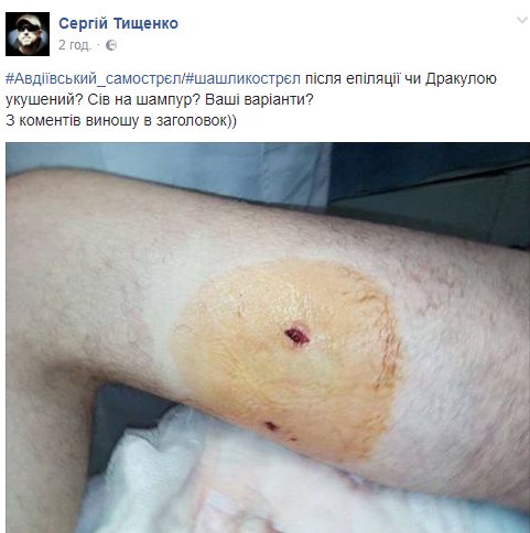 Реформація №4: Євген Дейдей, нардеп-підполковник, якого поранив шампур_7