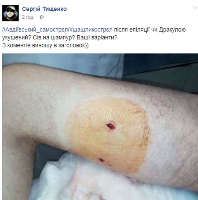 Реформація №4: Євген Дейдей, нардеп-підполковник, якого поранив шампур_7