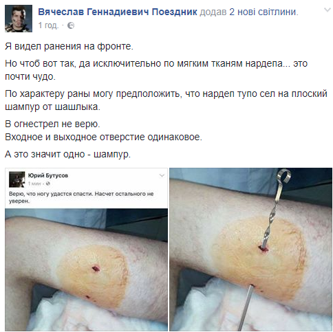 Реформація №4: Євген Дейдей, нардеп-підполковник, якого поранив шампур_9