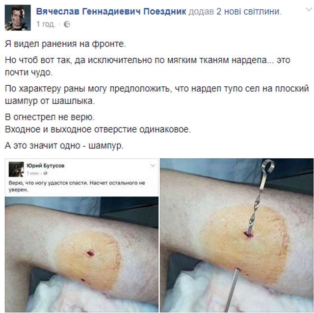 Реформація №4: Євген Дейдей, нардеп-підполковник, якого поранив шампур_9