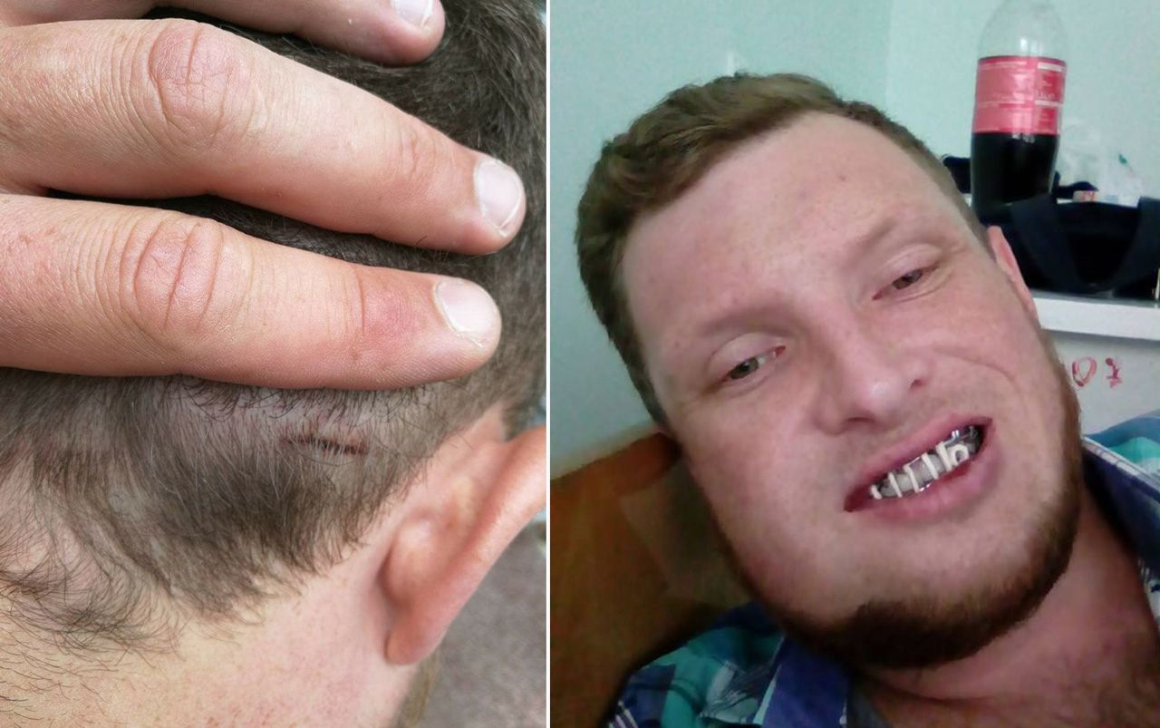 Підозрюваного у побитті журналіста  затримали і … відпустили_1