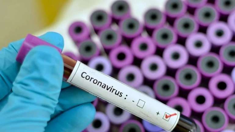 5 000 тестів на коронавірус завезли в лікарні Полтавщини
