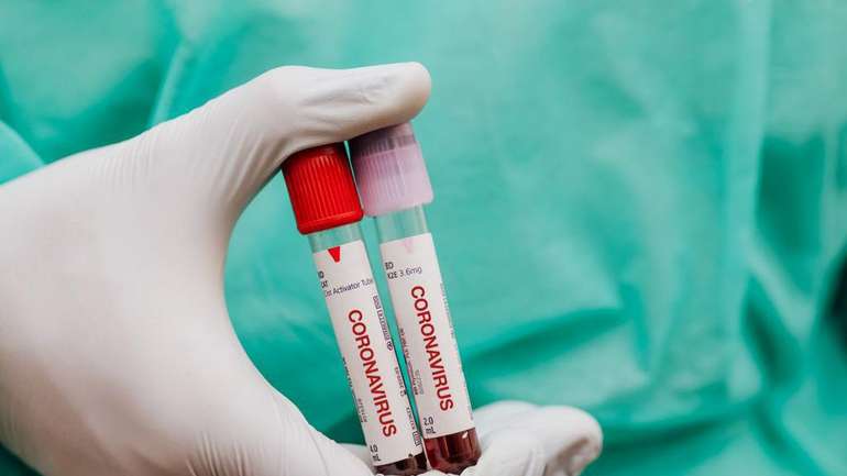 Лабораторно підтвердили перший випадок коронавірусу на Полтавщині – подробиці зараження