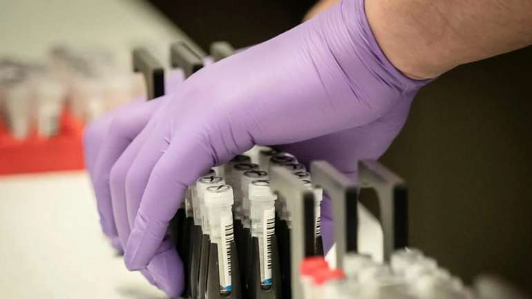 МОЗ повідомило про 5 випадків коронавірусу на Полтавщині