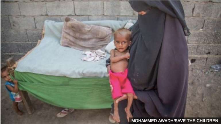 Двадцять шість людей сукупно володіють половиною багатств планети – Генсек ООН