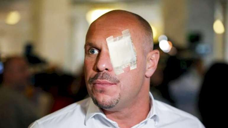 Аваков звітує про затримання підпалювача авто журналістів. Коли дійде черга до Киви?