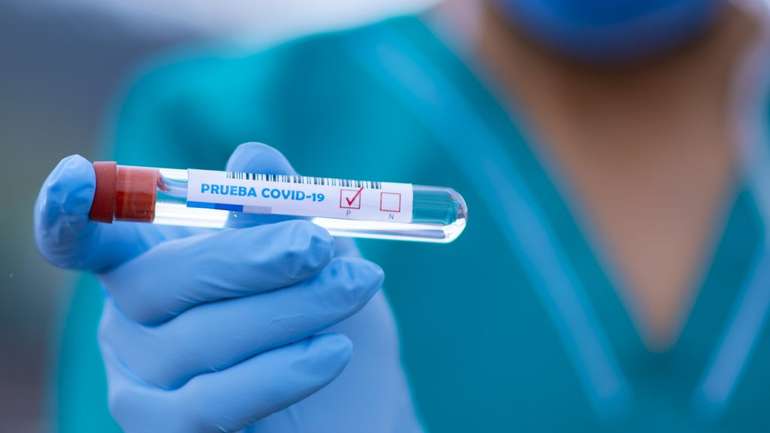 Статистика: у Полтаві 113 нових заражених на коронавірус