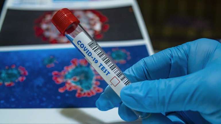Коронавірус пішов на спад: 7 нових випадків за добу на Полтавщині