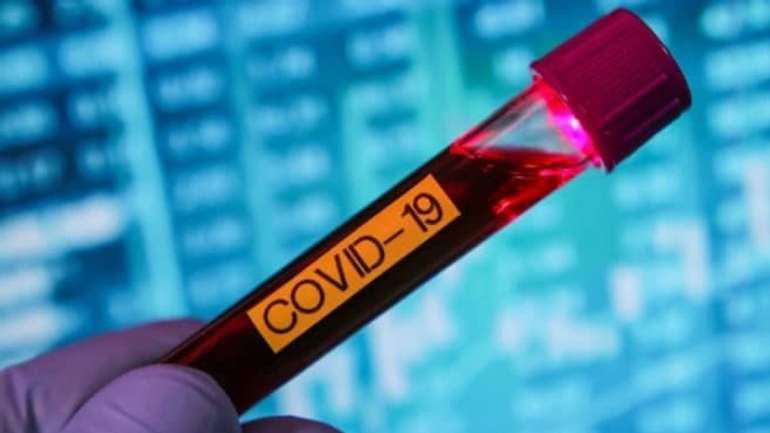 984 нових випадки COVID-19 зафіксовано в Україні