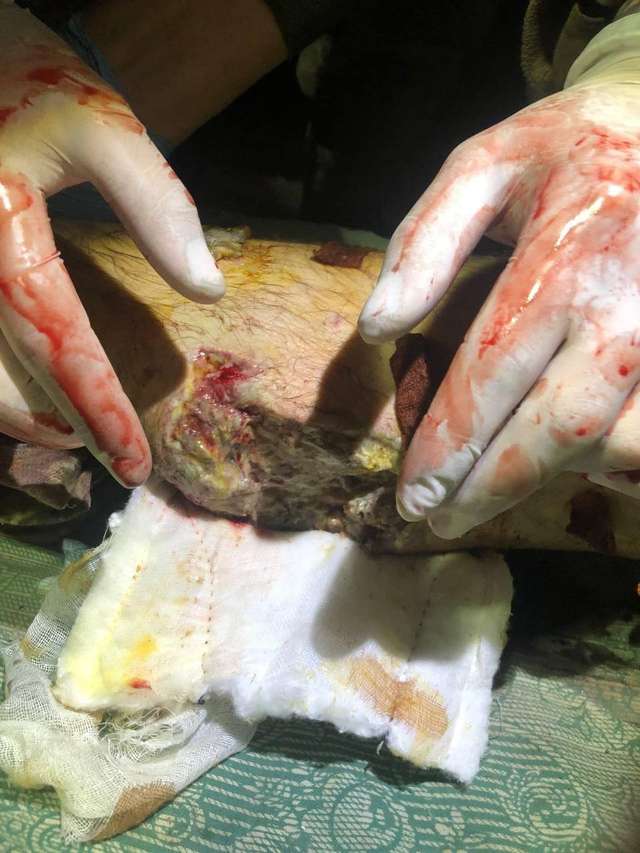 Поранені оборонці «Азовсталі» буквально гниють живцем, – Маріупольська міська рада_3