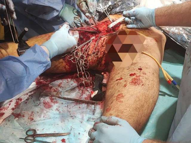 Поранені оборонці «Азовсталі» буквально гниють живцем, – Маріупольська міська рада_7