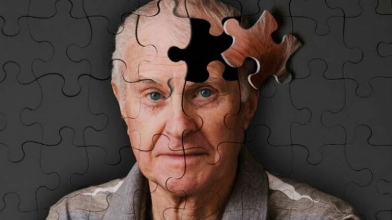 Вчені можуть створити ліки проти старіння за 5 років