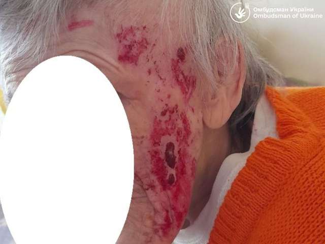 Львівський геріатричний пансіонат – душогубка для літніх українців_5