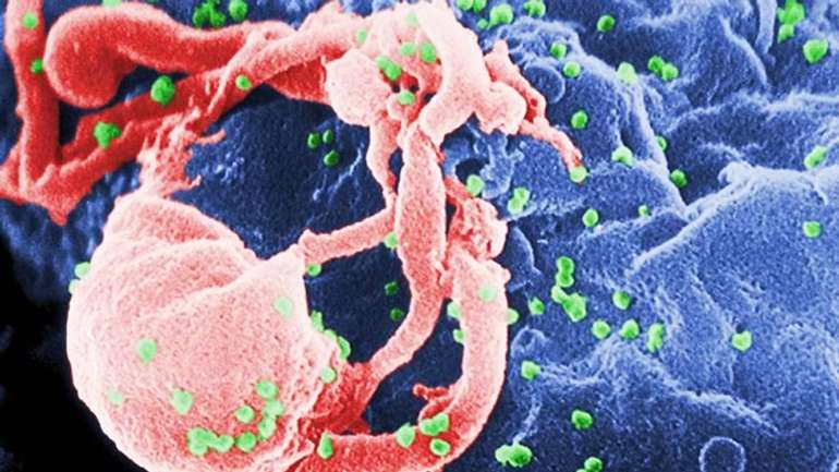 Американські біологи лікують ВІЛ шляхом зміни генів
