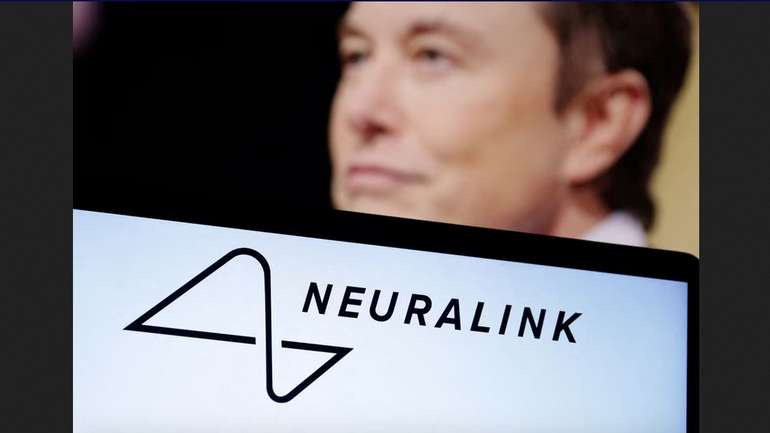Ілон Маск отримав дозвіл проводити клінічні випробування чипів Neuralink на людях