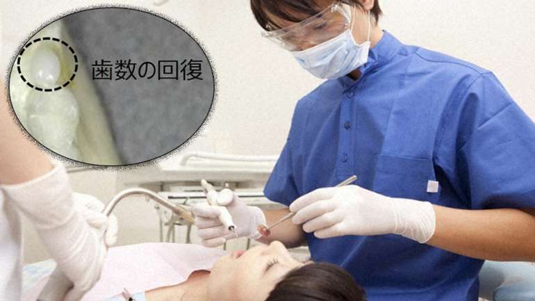 Японські медики навчилися вирощувати нові зуби у людей