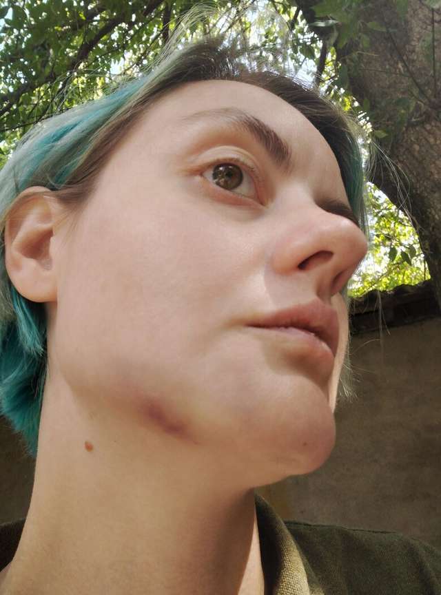 Закарпатського воєнкома Варі, який побив дружину воїна, звільнять із лав ЗСУ_9