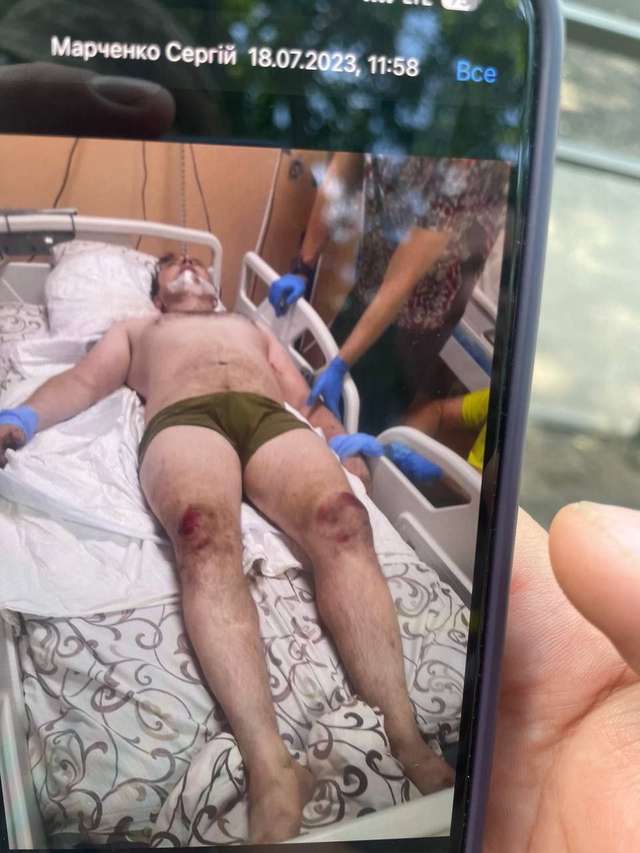 Українські гниди вбивають наших захисників прямо у лікарнях_1