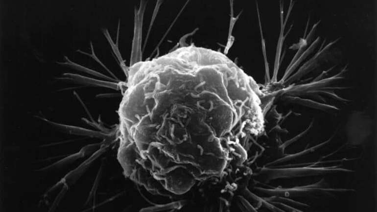 Біохіміки розробили препарат, який адресно руйнує рак