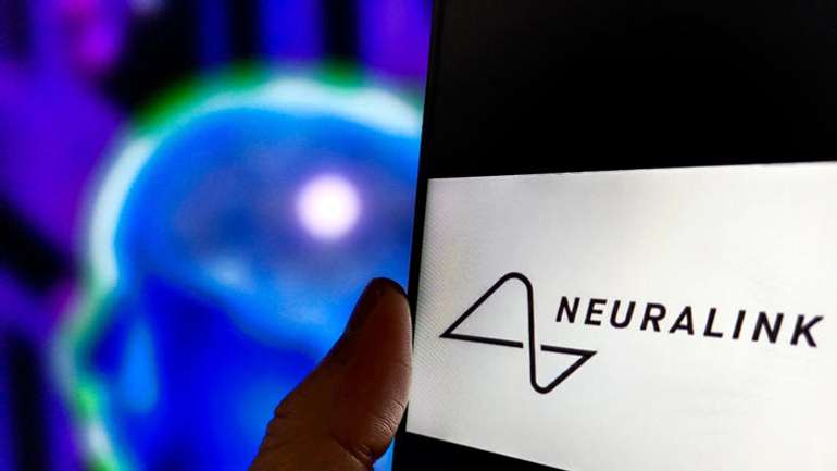 Імплантат компанії Neuralink, вживлений у мозок людини, вперше вийшов із ладу