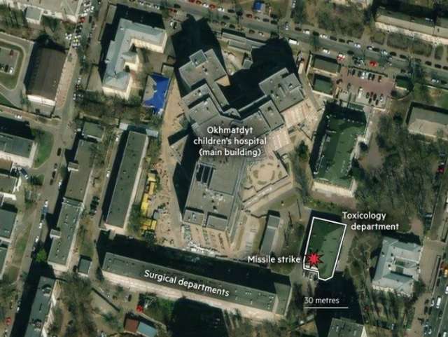 «Охматдит» під ударом терористів: Ізраїлю можна, а РФ ні?_1