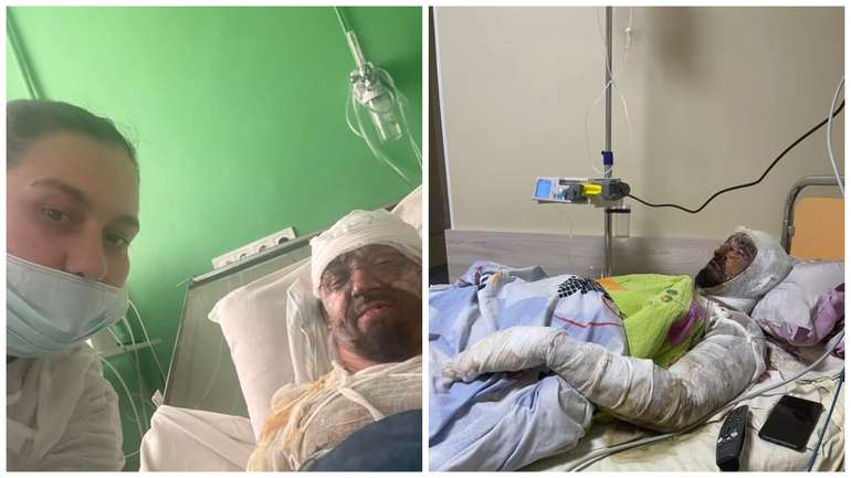 Воїн 128 бригади ТРО В'ячеслав Стаскевич отримав тяжкі поранення