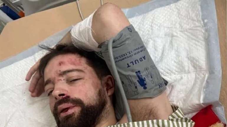На Київщині мобілізованого львівського викладача знайшли з проломленою головою