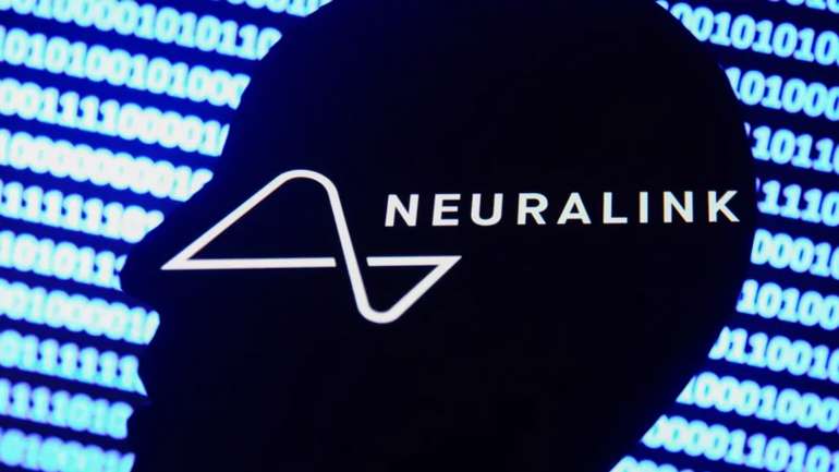 Масове чіпування. Neuralink Маска хоче вживлювати чипи тисячам людей щороку
