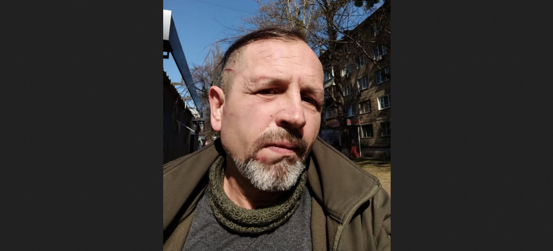 Колишній полонений Володимир Балух заявив, що його побили у приміщенні ТЦК Києва