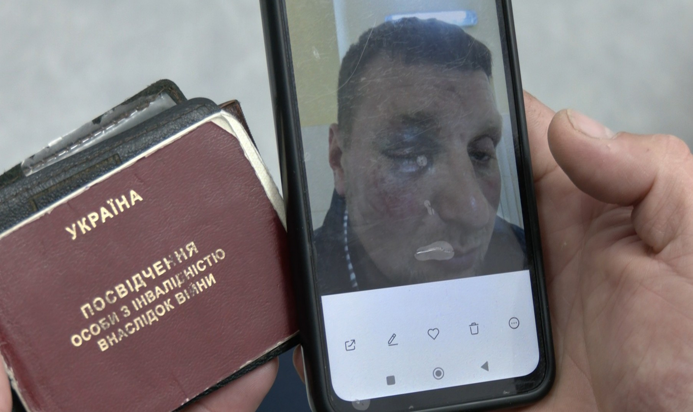 у Луцьку ветеран із пораненнями заявив про побиття та затримання людьми в балаклавах