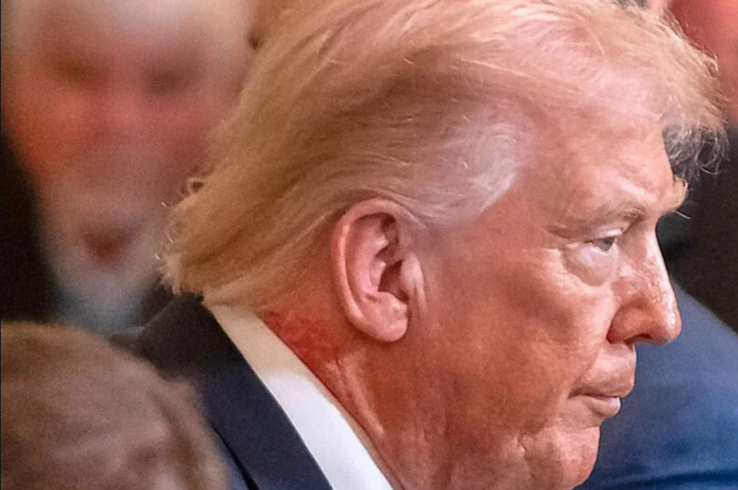 Екслікарі Білого дому забили на сполох через здоров’я Трампа