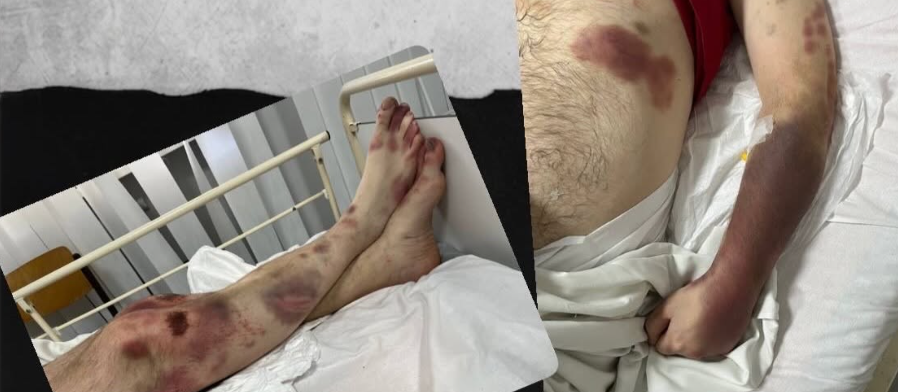 Батько в реанімації: киянка заявила про побиття родича в ТЦК